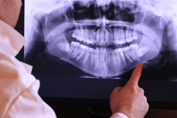 Best Emergency Treatment for Dental Infections or Abscesses in Long Beach, IN